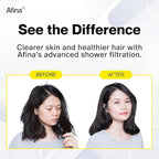 Afina Filtered Shower Head - Water Softener Showerhead with KDF-55 Shower Filter for Hard Water - High Pressure Rain Fall Experience - Universal Fit (Brushed Nickel)